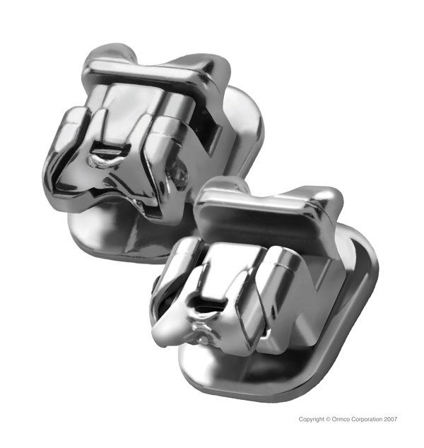 The Damon System Bailey Orthodontics